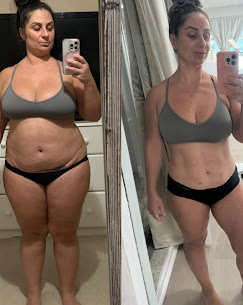 Weight Loss (GLP-1's) in Clearwater FL